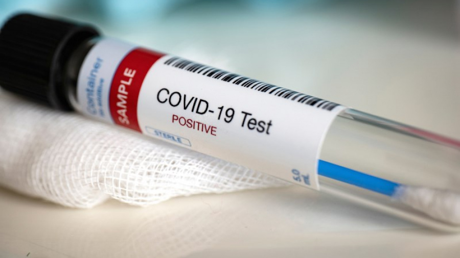 Coronavirus : Le gouvernement déploie 5 sites de tests gratuits pour les personnes symptomatiques